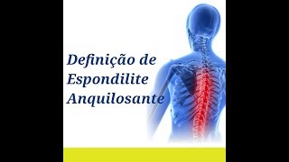 ESPONDILITE ANQUILOSANTE Doença Inflamatória Crônica da Coluna Clínica Fisioterapia Dr Robson Sitta [upl. by Hassin588]