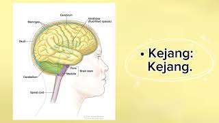 Leukodystrophy autosomal dominan [upl. by Deuno351]