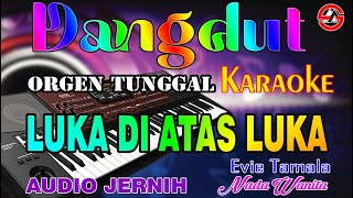 Luka di Atas Luka  Karaoke Nada Wanita Evie Tamala  Full Dangdut  Audio Jernih [upl. by Ikiv]