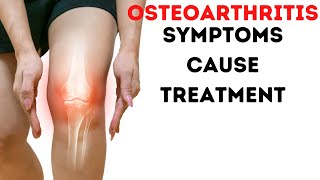 Osteoarthritis in Hindi  arthritis symptoms treatment cure [upl. by Ordnasil]