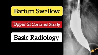 Barium swallow  Upper GI contrast study  Basic Radiology [upl. by Ralston]