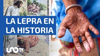 La lepra en la historia ¿por qué se creía que era un castigo divino [upl. by Keon]