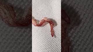 healing fungus mold skin morgellons disease alien implant health help jesus [upl. by Bumgardner]