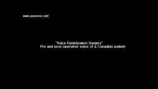 YESON VOICE CENTER  Voice Feminization Surgery Canada [upl. by Atiram]