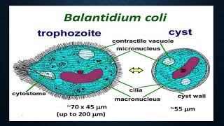 Balantidium coli [upl. by Rafaela]