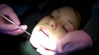 How to brush with braces Orthodontics Rogers AR [upl. by Notpmah]