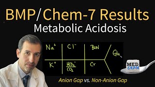 Metabolic Acidosis Explained CLEARLY Anion Gap vs Non Anion Gap [upl. by Namyac]