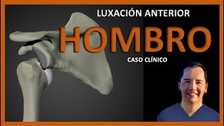 Luxación ANTERIOR del HOMBRO 🦴  Caso CLÍNICO 👨🏻‍💻 [upl. by Ynnej988]