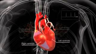 What is atrial fibrillation [upl. by Airdnas602]