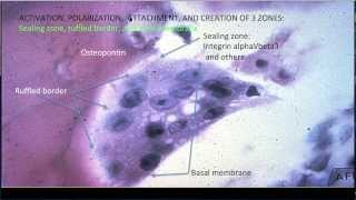 Learning Bone Growth 3 The Osteoclast [upl. by Hcir]