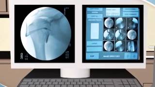 What to Expect during an Arthrogram procedure at RAYUS [upl. by Kreitman70]