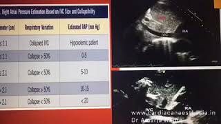 Transthoracic Echocardiography [upl. by Huldah]