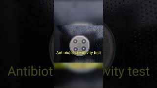 Antibiotic sensitivity test bacteriaisolateblood sample [upl. by Aicilet392]