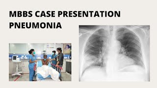 MBBS Case Presentation  Pneumonia [upl. by Geno]