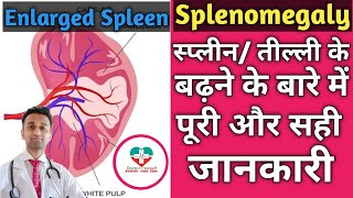 Splenomegaly। Speen प्लीहा तील्ली के बारे में पूरी जानकारी। CausesTypesTreatment Of Splenomgaly [upl. by Assenay108]