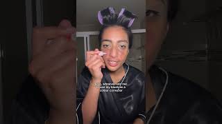 GRWM scalp eczema  eczema scars [upl. by Kingsly]