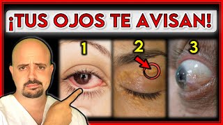 7 SEÑALES en tus OJOS que indican un PROBLEMA de SALUD  ¡NO los IGNORES [upl. by Suirtemed]