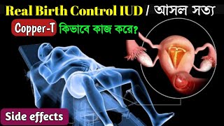 How IUD Works to Prevent Pregnancy Animation। Copper T Insertion and Side Effects । [upl. by Nnaaras]