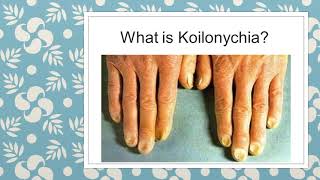 WHAT TO KNOW ABOUT KOILONYCHIA  NAIL DEFORMITIES  CLINICAL MEDICINE  MBBS REVISION GUIDE [upl. by Nawotna273]