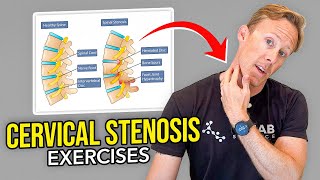 5 Exercises for Cervical Stenosis Arm Nerve Pain [upl. by Alak]