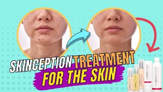 Skinception Review  Skinception Side Effects ⚠️Skinception Kollagen Intesiv⚠️ [upl. by Ilyk]