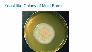 Dimorphic Fungi Sporothrichosis Hot Topic [upl. by Itsyrc203]