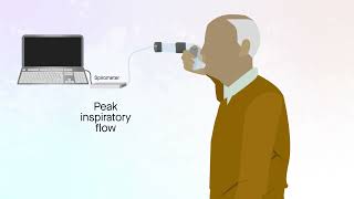 Easyhaler dry powder inhaler in patients with COPD [upl. by Goodhen704]