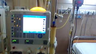 DFPP procedure using two dialysis machines [upl. by Ki]