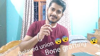 Delayed union 😨😨Bone grafting😨fracturerecoveryfracturedepressiontibiafracturedsadmotivation [upl. by Attiuqal899]