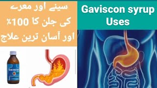 Gaviscon syrup uses in Urdu [upl. by Gifferd]