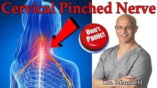 How to Overcome Cervical Pinched Nerve amp Radiculopathy Dont Panic  Dr Alan Mandell DC [upl. by Cosme]