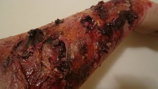 Severe Burn SPFX Makeup Tutorial [upl. by Nesbitt]