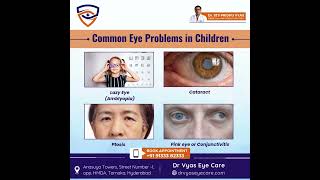 Common eye problems in children include astigmatism strabismus myopia hyperopia lazy eye amblyo [upl. by Liponis]