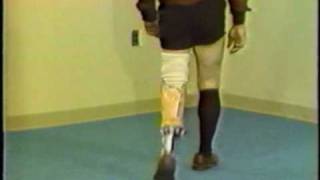 Gait deviations relating to a transtibial prosthesis [upl. by Enimrac20]