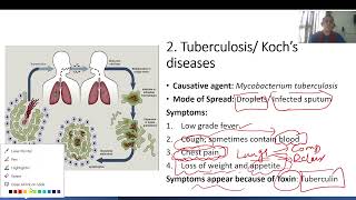 Bacterial Diseases Science ampTech upsc viralvideo pcs upsc [upl. by Ocimad270]