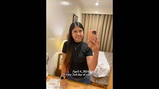 K1 VISA MEDICAL SPUTUM JOURNEY 2024 [upl. by Anirret]