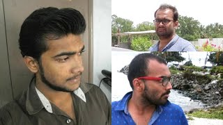 BALDING IN MY 20s IN INDIA 🇮🇳 Dealing With Balding As An Indian Man [upl. by Derraj]