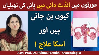 Anda Dani Ki Rasoli Ka Ilaj  Ovarian Cyst Signs And Symptoms In Urdu  Ovarian Cyst Kaise Thik Kare [upl. by Waers626]