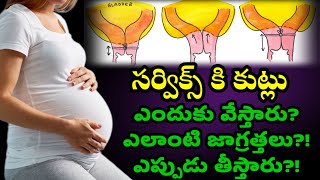 Cervical Stitches During Pregnancy Full Details in Telugu pregnant momgeethastips YouTube [upl. by Libnah]