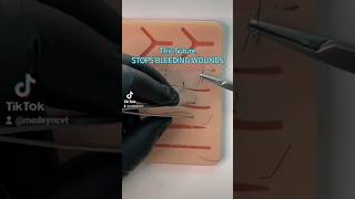 The quickest way to seal a bleeding vein or perforator under the skin wound bleeding surgeon nhs [upl. by Oterol150]