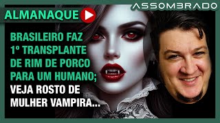 BRASILEIRO RECRIA ROSTO DE MULHER VAMPIRA E OUTRO FAZ 1º XENOTRANSPLANTE DE RIM e  AA 1101 [upl. by Rramahs]