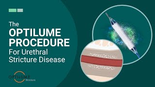 The Optilume Procedure For Urethral Stricture Disease [upl. by Conias442]