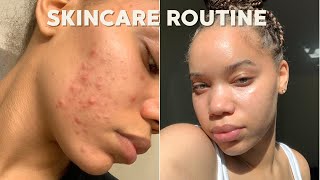 SKINCARE ROUTINE that works ACNE PRONE SKIN  Kaila Kake [upl. by Lydell985]