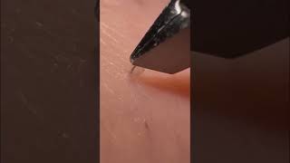 S35 毛抜き tweezers 毛根 satisfying plucking [upl. by Sy332]