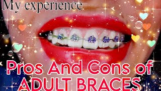 My Pros and Cons of braces And my experience having adult braces LolBorges [upl. by Eijneb]