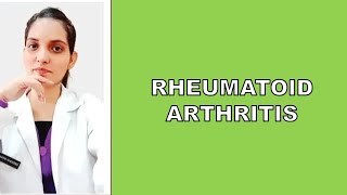 RHEUMATOID ARTHRITISPM LECTURE DefinitionCauses SymptomsDiagnosisManagement Treatment [upl. by Issy139]