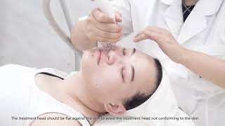 Velashape face lifting wrinkle removal treatment Sano Laser [upl. by Salb]