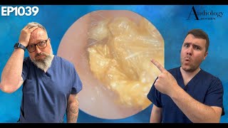 EAR WAX REMOVAL THAT DIFFICULT MRS B HAD TO HELP  EP1039 [upl. by Anura]