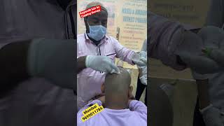 Is hijama therapy safe for hair growth kzhijama leechtherapy haircare hairfall shorts reels [upl. by Eirrot]