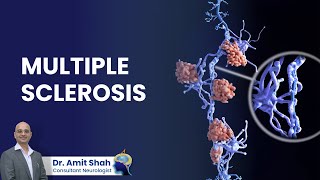 Understanding Multiple Sclerosis Causes Symptoms Diagnosis and Treatment Options  Dr Amit Shah [upl. by Capps790]